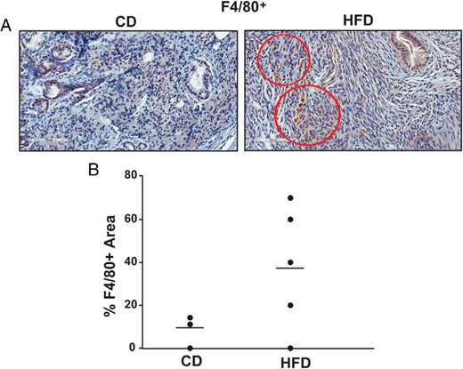 Macrophage F4/80+ cells in CD and HFD ectopic lesions in mice. A, Representative sections of ectopic lesions harvested from CD- and HFD-fed mice, showing positive immunostaining for F4/80 in HFD lesion-stromal cells. Scale bar, 100 μm. B, Graph represents percentages of F4/80+ areas in stromal cells of CD or HFD ectopic lesions, determined by counting the number of immunopositive areas over the total number of stromal areas evaluated ×100. Each point represents a lesion from an individual mouse.