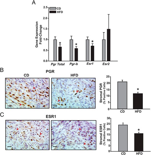 ESR and PGR are differentially expressed in CD and HFD ectopic lesions in a mouse model. A, Transcript levels of Pgr and Esr isoforms were determined in CD or HFD lesions by QPCR. Data (mean ± SEM) are expressed as FC from CD lesion group and were obtained from n = 7 lesions, with each lesion isolated from an individual mouse per diet group. B and C, Representative sections of CD and HFD ectopic lesions showing PGR-positive (B) and ESR1-positive (C) stromal cells (indicated by red arrowheads). Four lesions per dietary group, each representing an individual mouse, were analyzed. Scale bar, 20 μm. For B and C, the percentages of immunostaining cells (expressed as mean ± SEM) were quantified by counting the number of immunopositive stromal nuclei over the total number of stromal cells per field and are presented as bar graphs; *, P < .05 by Student's t test.