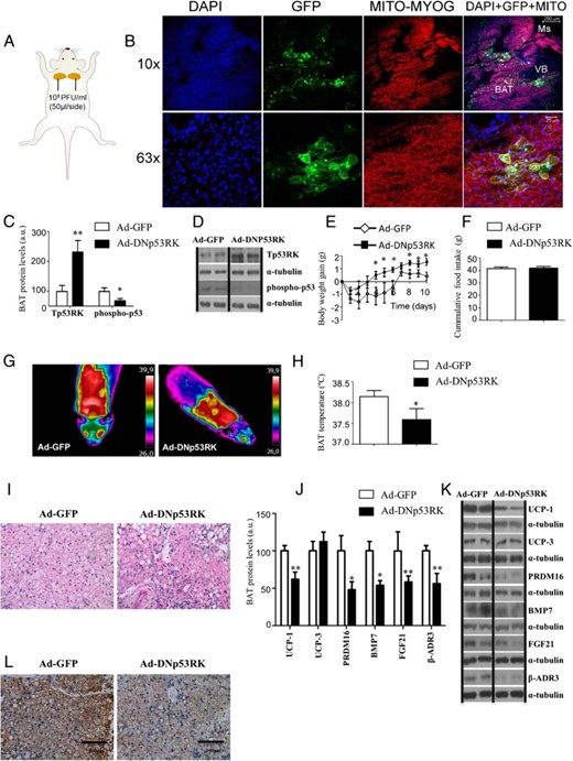 Metabolic phenotype and BAT metabolism in WT mice fed a chow diet after the genetic down-regulation of p53 specifically in BAT. A, Bilateral injections and doses of Ad-GFP or Ad-DNp53RK in the two lobes of BAT. B, Immunofluorescence of DAPI (blue), GFP (green), mitochondria (red), and colocalization of DAPI, GFP, and mitochondria in the BAT of mice after the local injection of Ad-GFP. GFP is not detected in muscle (Ms; myoglobin also fluorescent in red) or in the vessel bundle (VB; only positive for DAPI). C and D, Protein levels of Tp53RK and phospho-p53 after Ad-GFP and Ad-DNp53RK(−) delivery on BAT. E, Body weight gain of male WT mice on chow diet after 10 days after adenoviral inoculation. F, cumulative food intake. G, representative pictures of BAT interscapular temperature in animals housed at room temperature. H, BAT temperature. I, Representative pictures of BAT histology. J and K, Protein levels of UCP1 UCP3, Prdm16, BMP7, FGF21, and β-AR3 after Ad-GFP and Ad-DNp53RK(−) delivery on BAT. L, Representative pictures of BAT UCP1 immunohistochemistry. Divided lines indicate splicings in the figure. *, P < .05, **, P < .01, ***, P < .001 (n = 7–8 per group).