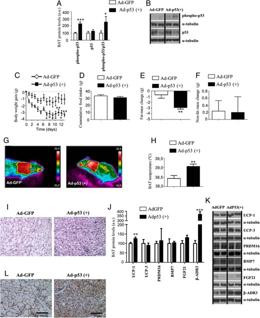 Metabolic phenotype and BAT metabolism in WT mice fed a HFD after genetic overexpression of p53 specifically in BAT. A and B, Phospho-p53 and p53 ratio in BAT of adult obese WT mice after Adp53(+) delivery compared with Ad-GFP controls. C, Body weight gain of male WT mice on HFD after 13 days after adenoviral inoculation. D, Cumulative food intake. E, Fat mass. F, Nonfat mass. G, Representative pictures of BAT interscapular temperature in animals housed at room temperature. H, BAT temperature. I, Representative pictures of BAT histology. J and K, Protein levels of UCP1 UCP3, Prdm16, BMP7, FGF21, and β-AR3 after Ad-GFP and AdP53(+) delivery on BAT. L, Representative pictures of BAT UCP1 immunohistochemistry. Divided lines indicate splicings in the figure. *, P < .05, **, P < .01, ***, P < .001 (n = 7–8 per group).