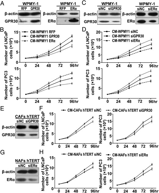 High expression of GPR30 or low expression of ERα in stromal cells promote PCa cell proliferation in a paracrine manner. A, C, E, and G, Prostate stromal cells were transfected with expression plasmid (A) or siRNA (C, E, and G) for GPR30 and ERα. Overexpression and knockdown were verified by Western blot analysis after 72 hours. Notice that Western blot images were obtained using different sensitivity settings for overexpression and knockdown experiments in WPMY-1 cells, lower sensitivity for overexpression (A), and higher sensitivity for knockdown experiments (C). B, D, F, and H, PCa cell lines LNCaP and PC3 were treated with CM from transfected stromal cells. Cells were counted after 24, 48, 72, and 96 hours, respectively. The proliferation curves of LNCaP and PC3 cells are depicted (n = 3).