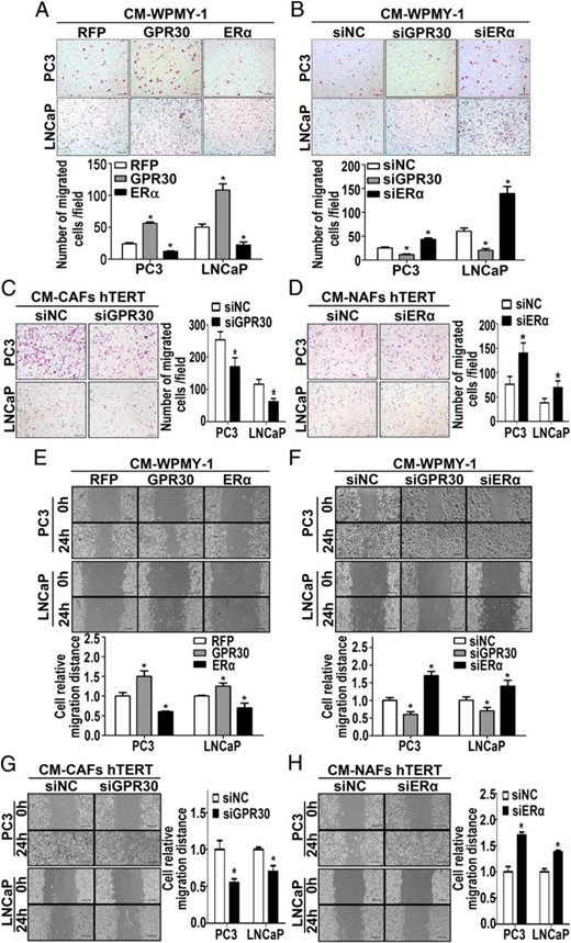 CM from stromal cells with high expression of GPR30 or low expression of ERα stimulate PCa cell migration. A–D, The Transwell assay was performed to evaluate the effect of CM from transfected stromal cells on migration of LNCaP and PC3 cells. CMs were placed into the lower chamber of the Transwell plates (BD Biosciences). LNCaP and PC3 cells were put into the top chamber and allowed to migrate for 24 hours. The Transwell inserts were fixed and stained before light microscopy visualization and cell number counting. Results are presented as mean ± SD (n = 5). *, P < .05 vs controls. Bar, 200 μm. E–H, Wound-healing assay of LNCaP and PC3 cells incubated for 0 or 24 hours with CM from transfected stromal cells. ImageJ software (National Institutes of Health) was used for the quantification of wound closure. Results are presented as mean ± SD (n = 3). *, P < .05 vs controls. Bar, 200 μm.