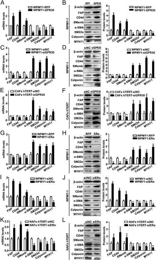 High expression of GPR30 and/or low expression of ERα is related to the CAF-like phenotype in prostate stromal cells. A–D, Real-time RT-PCR and Western blot analysis of gene expression in WPMY-1 cells transfected with GPR30 expression plasmid (A and B) or siRNA (C and D) at the mRNA level and protein level. E and F, Real-time RT-PCR and Western blot analysis of gene expression in immortalized CAFs transfected with siGPR30 at the mRNA (E) and protein level (F). G–J, Real-time RT-PCR and Western blot analysis of gene expression in WPMY-1 cells transfected with ERα expression plasmid (G and H) or siRNA (I and J) at the mRNA and protein level. K and L, Real-time RT-PCR and Western blot analysis of gene expression in immortalized NAFs transfected with siERα at mRNA (K) and protein level (L). Results are presented as mean ± SD (n = 3). *, P < .05 vs controls.