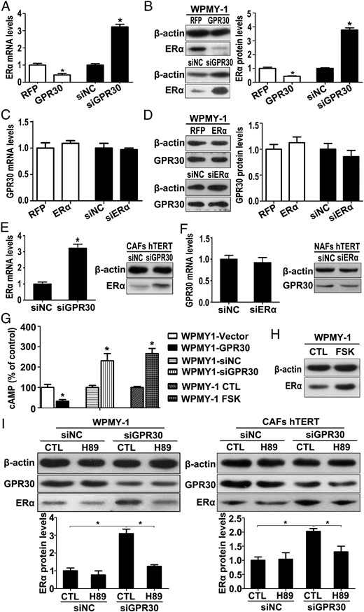 GPR30 represses ERα expression in prostate stromal cell via inhibition of the cAMP/PKA signaling pathway. A and B, Real-time RT-PCR and Western blot analysis of ERα expression in WPMY1-GPR30 or WPMY1-siGPR30 at mRNA (A) and protein level (B). C and D, Real-time RT-PCR and Western blot analysis of GPR30 expression in WPMY1-ERα or WPMY1-siERα at the mRNA (C) and protein level (D). E, Real-time RT-PCR and Western blot analysis of ERα expression in immortalized CAFs transfected with siGPR30 at mRNA (left panel) and protein level (right panel). F, Real-time RT-PCR and Western blot analysis of GPR30 expression in immortalized NAFs transfected with siERα at mRNA (left panel) and protein level (right panel). G, WPMY-1 cells were transfected with GPR30 expression plasmid or siRNA for 48 hours or treated with 1 μM FSK for 10 minutes, and then concentrations of cAMP were quantified using the cAMP-Glo assay (n = 3). *, P < .05 vs corresponding controls (CTLs). H, WPMY-1 cells were treated with 1 μM FSK for 24 hours, and ERα protein expression was demonstrated by Western blot. I, Western blot analysis of ERα protein expression in WPMY-1 cells (left panel) and immortalized CAFs (right panel) transfected with siGPR30 and treated with 2 μM H89 (upper panel), and quantification by densitometry (lower panel). Results are presented as mean ± SD (n = 3). *, P < .05.