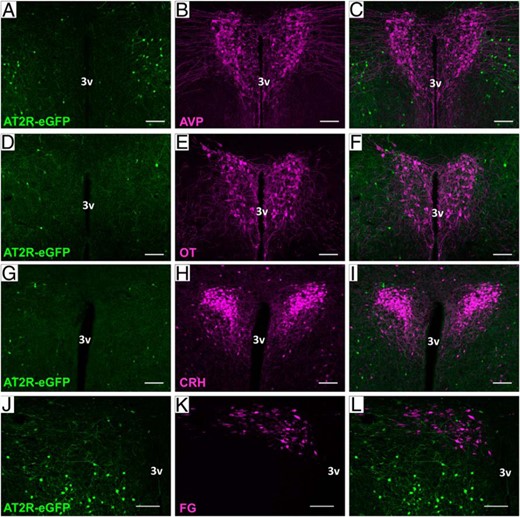 AT2R are not expressed on OT, AVP, CRH, or RVLM-projecting neurons in the PVN. Representative coronal sections through the PVN of the AT2R-eGFP reporter mice depicting eGFP in green and either (A–C) AVP, (D–F) OT, (G–I) CRH-tdTomato cells, or (J–L) FG-labeled RVLM-projecting cells in red. All staining was performed on 4 mouse brains (ie, n = 4). 3v, third ventricle. Scale bars, 100 μm.