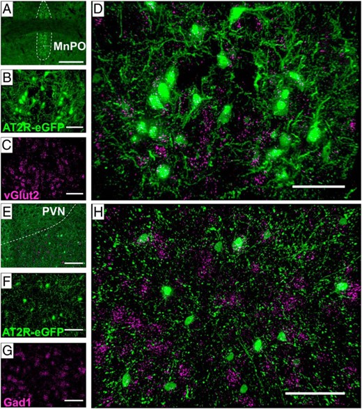 Phenotype of AT2R-eGFP neurons in selected regions containing glutamatergic or GABAergic AT2R-eGFP inputs into the PVN. Representative coronal sections through (A–D) the MnPO and (E–H) the peri-PVN of brains collected from an AT2R-eGFP mouse depicting eGFP in green and either vGlut2 mRNA (C and D) or Gad1 mRNA (G and H) in magenta. A, A low-magnification image through the MnPO, highlighting the area with a dashed outline. B–D, Projection images through the MnPO depicting AT2R-eGFP in green (B), vGlut2 mRNA in magenta (C), and the merged image (D) demonstrating extensive overlap between AT2R-eGFP neurons and vGlut2 mRNA in the MnPO. E, A low-magnification image through the PVN and surrounding area, highlighting the PVN with a dashed outline. F–H, Projection images through the peri-PVN depicting AT2R-eGFP in green (F), Gad1 mRNA in magenta (G), and the merged image (H) demonstrating extensive overlap between AT2R-eGFP neurons and Gad1 mRNA. These studies were performed on 4 mouse brains (ie, n = 4). Scale bars: 200 μm (A), 50 μm (B–D and F–H), and 100 μm (E).