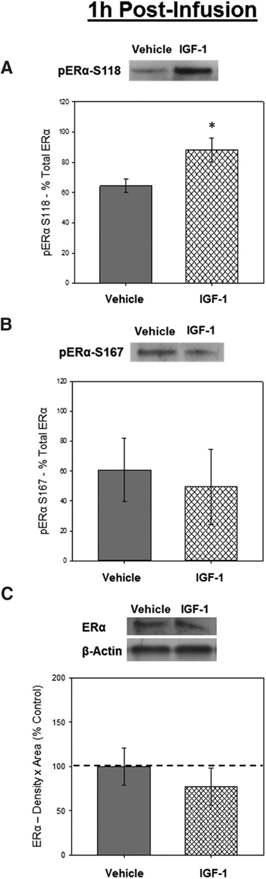 Effects of IGF-1 infusion on levels of phosphorylated ERα in the hippocampus 1 hour after infusion. Hippocampi were collected from ovariectomized rats 1 hour after an i.c.v. infusion of aCSF vehicle or IGF-1. Western blotting data showing effects of treatments on levels of phosphorylated ERα at site S118 (A), phosphorylated ERα at site S167 (B), and total ERα (C). Mean density × area (±SEM) relative to total ERα (A and B) or relative to vehicle control group (C); *, P < .05. Representative blot images for phosphorylated ERα at S118, phosphorylated ERα at S167, total ERα, and the loading control β-actin are shown in insets above respective graphs.