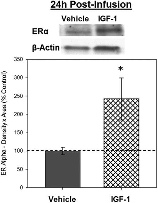 Effects of IGF-1 infusion on total levels of ERα in the hippocampus 24 hours after infusion. Hippocampi were collected from ovariectomized rats 24 hours after an i.c.v. infusion of aCSF vehicle or IGF-1. Western blotting data showing effects of treatments on levels of ERα. Mean density × area (±SEM) relative to vehicle control group; *, P < .05. Representative blot images for ERα and the loading control β-actin are shown in insets above the graph.