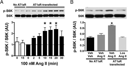 Effect of Ang II on mTORC1 activity in hypothalamic GT1–7 cells. A, Ang II (100nM) increased phosphorylated S6K (p-S6K) in a time-dependent manner in GT1–7 cells transfected with AT1aR (closed columns). Ang II had no effect on p-S6K at 15 minutes without the transfection (white columns). B, Effect of losartan (Los) on Ang II-induced activation of mTORC1 pathway. In AT1aR-transfected GT1–7 cells, losartan blocked the increase in phosphorylation of S6K by Ang II. Values are mean ± SEM, n = 3–4; *, P < .05 vs baseline (0 min) (A) and all other groups (B), one-way ANOVA.