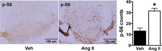 Effect of ICV Ang II on mTORC1 signaling in the SFO. Relative to vehicle, ICV administration of Ang II (1 μg, 30 min) significantly increased the positive cell number of phosphorylated S6 (p-S6) in the SFO of wild-type mice. Microphotographs (×20 magnification) of phospho-S6 staining in the SFO and quantification data are displayed. Values are mean ± SEM, n = 4–6; *, P < .05, t test.