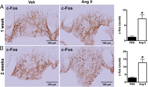 Effect of sc Ang II infusion on neuronal activity in the SFO of wild-type mice. Ang II infusion (1000 ng/kg · min) for 1 week (A) or 2 weeks (B) significantly increased the positive cell number of c-Fos in the SFO. Microphotographs (×20 magnification) of c-Fos immunoreactivity in the SFO and quantification data are displayed. Values are mean ± SEM, n = 5–8 per treatment; *, P < .05, t test.