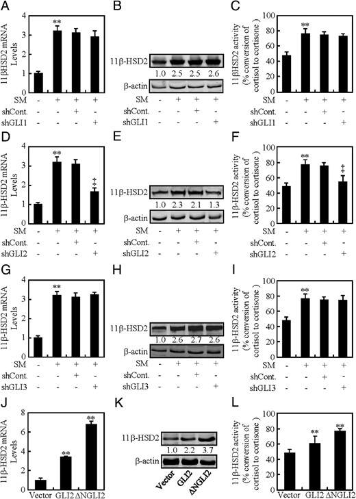 GLI2 is essential for HH-induced 11β-HSD2 expression. A–C, 11β-HSD2 mRNA and protein levels, and 11β-HSD2 activity after GLI1 was knocked down in BeWo cells in the presence of CM or SM. D–F, 11β-HSD2 mRNA and protein levels, and 11β-HSD2 activity after GLI2 was knocked down in BeWo cells in the presence of CM or SM. G–I, 11β-HSD2 mRNA and protein levels, and 11β-HSD2 activity after GLI3 was knocked down in BeWo cells in the presence of CM or SM. J–L, 11β-HSD2 mRNA and protein levels, and 11β-HSD2 activity in BeWo cells transfected with the indicated plasmids. RNA and protein abundance was normalized to β-actin, respectively. ** and ‡, P < .01 vs CM with control-shRNA, SM with control-shRNA, or empty vector; n = 6; error bar, SD.