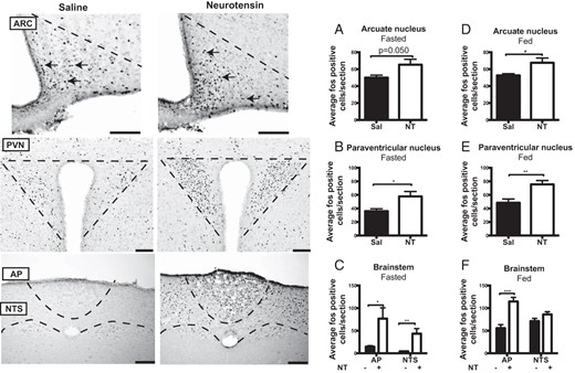 c-Fos immunohistochemistry. NT-induced c-Fos-IR after an overnight fast during 2 hours of continuous fasting (A–C) or during 2 hours of refeeding (D–F) in the ARC, PVN, and brainstem (n = 7). Scale bars, 100 μM. Data were tested with unpaired, two-tailed t tests. *, P < .05; **, P < .01; ***, P < .001. Error bars represent SEM. sal, saline.