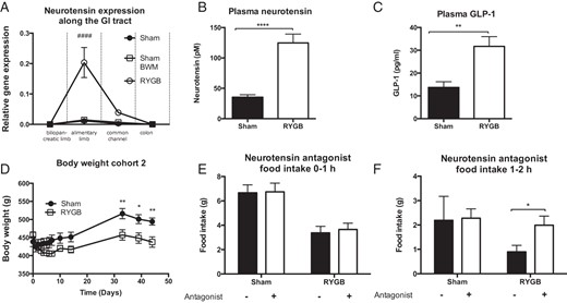 NT in a rat model of RYGB. A, NT expression was increased in the alimentary limb in RYGB compared with sham and sham BWM rats 23 weeks after surgery (cohort 1). B, Plasma levels of total NT in free-fed rats were increased in RYGB compared with sham rats 5 weeks after surgery before commencement of antagonist studies (cohort 2). C, GLP-1 levels in free-fed rats were increased in plasma in RYGB compared with sham rats at termination (cohort 2). D, Sham-operated rats had significantly higher body weight than RYGB rats (cohort 2). E and F, The NT antagonist SR142948A increased food intake transiently during the second hour of refeeding (cohort 2) (n = 5, A, and n = 8–10, C–F). Data were tested with a two-way ANOVA repeated measurements with Tukey post hoc test (A), unpaired, two-tailed t tests (B and C), a two-way ANOVA repeated measurements with Sidak post hoc test (D), and two-way ANOVA with Bonferroni-corrected paired t tests as post hoc tests (E and F). ####, P < .0001 (RYGB vs sham and sham BWM); *, P < .05, **, P < .01, ****, P < .0001 (RYGB vs sham). Error bars represent SEM..