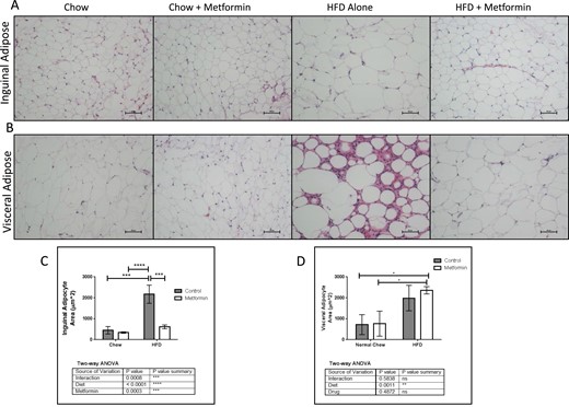 Normalizing effects of metformin on white adipose tissue in HFD. Representative hematoxylin and eosin sections of (A) inguinal and (B) visceral adipose depots. Scale bar = 50 μm. (C) Metformin significantly decreased inguinal adipocyte size in HFD mice. (D) HFD mice with or without metformin treatment have hypertrophic adipocytes vs chow mice, which was not rescued with metformin treatment. Data represent mean ± SD, n = 3, analyzed with two-way ANOVA and Tukey post hoc testing.