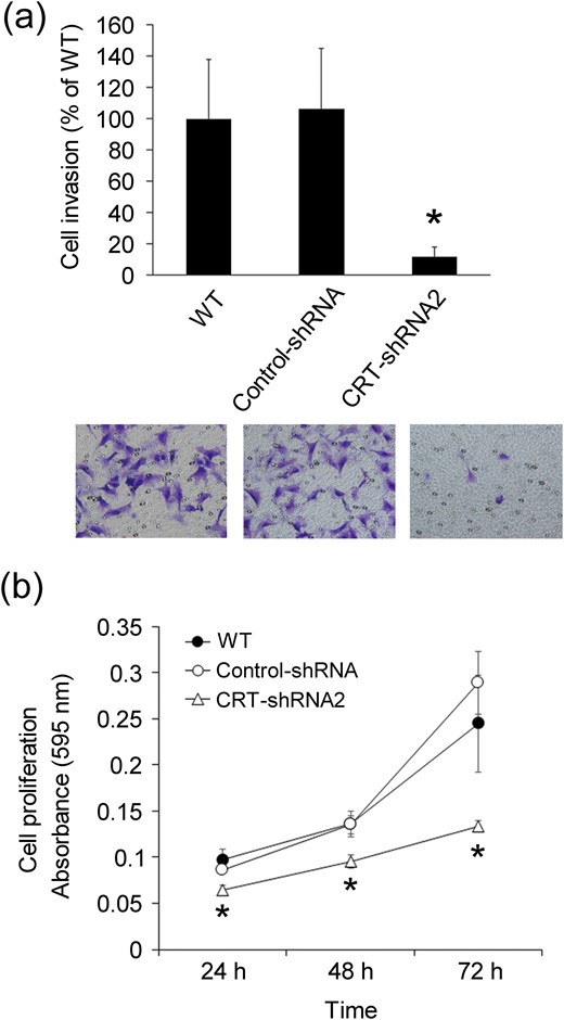 Effects of stable knockdown of CRT expression on Matrigel invasion in HTR8/SVneo cells. (a) Cellular invasion was estimated at 24 hours after plating of WT, control-shRNA, and CRT-shRNA2 cells using the Matrigel invasion assay, as described in Methods. Columns show the mean ± standard deviation of three independent experiments. *P < 0.05 vs control-shRNA. Representative images are shown (bottom). Magnification ×200. (b) Cellular proliferation was estimated photometrically in WT, control, and CRT-knockdown cells by measuring the absorbance at 595 nm, as described in Methods. The cell number was estimated 24, 48, and 72 hours after plating. Data represent the mean ± standard deviation of three independent experiments. *P < 0.05 vs the same time point for control-shRNA.