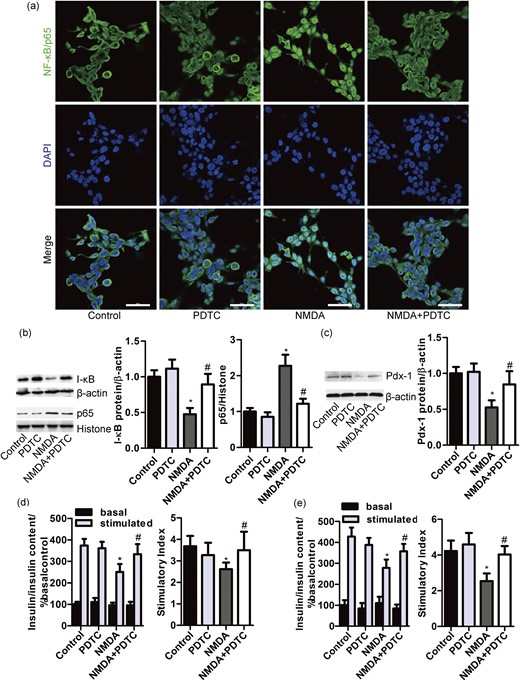 NMDA impairs β-cell function by activation of NF-κB. (a) Representative images of the nuclear localization of NF-κB/p65 in MIN6 cells exposed to NMDA (10 mM) for 48 hours alone or in combination with PDTC (50 μM) (Bar = 50 μm). Western blot and bar graph showing the protein expression of I-κB, (b) nuclear p65 and (c) Pdx-1 in MIN6 β-cells exposed to NMDA (10 mM) for 48 hours with or without PDTC (50 μM) [n = 8; (b) F = 52.279; (c) F = 26.738; *P < 0.05 vs the control group; #P < 0.05 vs the NMDA group). Bar graphs demonstrating insulin secretion during 1-hour incubation with 2.8 mM (basal) and 16.7 mM glucose (stimulated) from (d) MIN6 β-cells and (e) primary rat islets treated with NMDA (10 mM) alone or in combination with PDTC (50 μM) for 48 hours, normalized to insulin content and basal secretion of the control group [n = 5; (d) F = 12.474; (e) F = 18.631;*P < 0.05 vs the control stimulated; #P < 0.05 vs the NMDA group). The insulin stimulatory index denotes the ratio of secreted insulin during 1-hour incubation with 16.7 mM or 2.8 mM glucose (n = 5; *P < 0.05 vs the control group; #P < 0.05 vs the NMDA group).