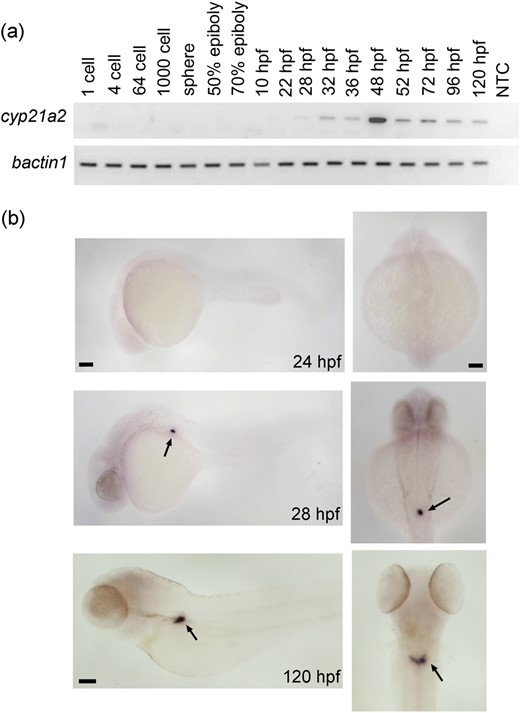 Zebrafish cyp21a2 expression is largely restricted to the interrenal gland. (a) Analysis of cyp21a2 expression during embryonic and early larval development by RT-PCR with b-actin1 as an internal standard (gel images inversed). A no-template control sample (NTC) served as negative control. The onset of detectable cyp21a2 expression is at 28 hpf, after which cyp21a2 continues to be expressed at all stages examined. (b) Images of wild-type larvae at different stages after WISH against cyp21a2. Left panels show lateral view, with head to the left; right panels show a dorsal view. No staining is seen in 24-hpf embryos. In 28-hpf embryos and 120-hpf larvae, strong staining is observed in the interrenal gland region, with some faint signal detected at 120 hpf in the head (arrows). Scale bar: 0.1 mm.