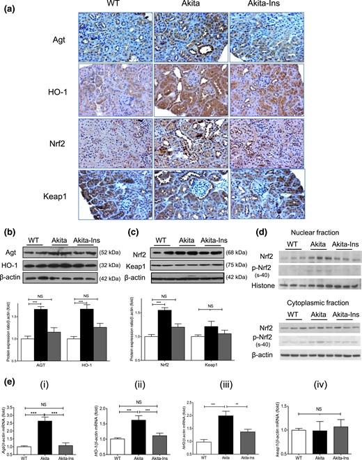 Renal Agt, HO-1, Nrf2, and Keap1 expression in Akita mice. (a) Agt, HO-1, Nrf2, and Keap1 immunostaining (magnification ×200). (b) WB of Agt and HO-1 in total lysates. (c) WB of Nrf2 and Keap1 in total lysates. (d) WB of Nrf2 and p-Nrf2 (s-40) in nuclear and cytoplasmic fractions of RPTs. (e) (i–iv) RT-qPCR of Agt, HO-1, Nrf2, and Keap1 mRNA expression in RPTs of WT controls, Akita, and Akita mice + insulin (Ins). Values are mean ± SEM, n = 8 per group. **P < 0.01; ***P < 0.005; WT controls (open bars); Akita (solid bars), and Akita mice + Ins (gray bars). NS, not significant.