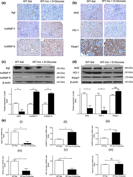 Renal Agt, hnRNP F/K, Nrf2, HO-1, and Keap1 expression in hyperinsulinemic-euglycemic mice. (a) Immunostaining of Agt, hnRNP F, and hnRNP K and (b) Nrf2, HO-1, and Keap1 (magnification ×200). (c) WB of Agt, hnRNP F, and hnRNP K and (d) Nrf2, HO-1, and Keap1 expression in isolated RPTs from WT mice after a 3-hour infusion with saline (Sal) or insulin (Ins) + d-glucose. (e) RT-qPCR of (i) Agt, (ii) hnRNP F, (iii) hnRNP K, (iv) Nrf2, (v) HO-1, and (vi) Keap1 mRNA expression in isolated RPTs from WT mice after a 3-hour infusion with saline (Sal; open bars) or Ins + d-glucose (solid black bars). Values are mean ± SEM, n = 8 per group. *P < 0.05; **P < 0.01. NS, not significant.
