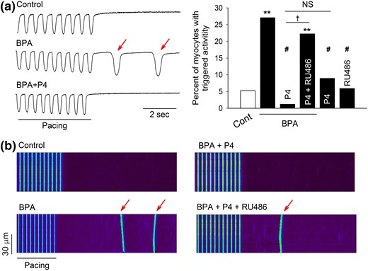 P4 inhibits BPA-induced triggered activities in isolated female rat ventricular myocytes. (a) Left: Representative contraction traces under control (Cont), BPA, and BPA + P4. Red arrows indicate spontaneous after-contraction (i.e., triggered activity) after pacing. Right: Percentages of myocytes with triggered activities under indicated treatments (n = 30 to 50 myocytes for each group from four hearts). (b) Representative confocal images of Ca2+ transients in myocytes elicited by repeated pacing under various treatments. Red arrows indicate spontaneous Ca2+ after-transients (i.e., triggered activity) after pacing. For all experiments, BPA and P4 = 1 nM; RU486 = 1 μM. **P < 0.01; #P > 0.1 versus control; †P < 0.01. NS, not significant (χ2 test).