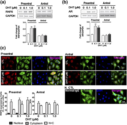 DHT increases RNF6 and AR contents and nuclear RNF6 localization in GCs from preantral and antral follicles in vitro. GCs isolated from preantral and antral follicles were cultured with DHT (0 to 1 µm, 24 hours), and changes in (a) RNF6 and (b) AR contents were assessed by Western blot. Results are expressed as means ± standard error of the mean (n = 4) and analyzed by two-way ANOVA and Bonferroni post hoc test. **P < 0.01 versus CTL. (c) Subcellular localization of RNF6 was analyzed by IF and is shown as percentage of total cells. Data were analyzed by two-way ANOVA and Bonferroni post hoc test. N+C RNF6 localization: **P < 0.01; ***P < 0.001 versus CTL. #P < 0.05; ##P < 0.01 (DHT 1.0 µm versus DHT 0.1 µm). Normal rabbit IgG was used for negative control (N CTL). GAPDH, glyceraldehyde 3-phosphate dehydrogenase.