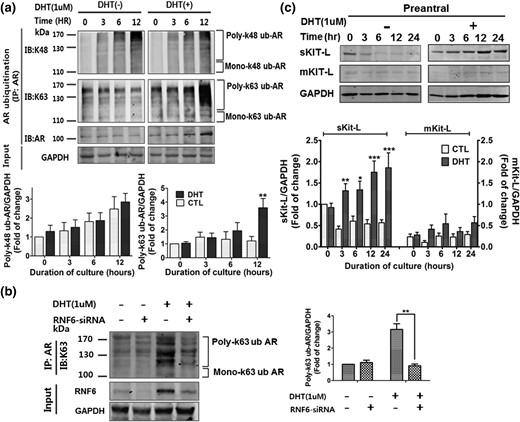 RNF6 silencing attenuates DHT-induced K63-linked polyubiquitination of AR, and DHT upregulates its down-stream target sKit-L. (a) GCs from preantral and antral follicles were cultured with DHT (0 to 1 µm, 24 hours), subjected to immunoprecipitation with anti-AR, and followed by immunoblotting with anti-K48 ubiquitin or K63 ubiquitin. Results are expressed as means ± standard error of the mean (SEM) (n = 3) and analyzed by two-way ANOVA and Bonferroni post hoc test. **P < 0.01 versus CTL. (b) GCs were transfected with RNF6 siRNA (50 nM, 12 hours; scramble siRNA as control) and then treated with DHT (1 µm, 24 hours). Cells were immunoprecipitated using anti-AR, and the precipitate was immunoblotted with anti-K63 ubiqutin antibody. Results are expressed as means ± SEM (n = 3) and analyzed by two-way ANOVA and Bonferroni post hoc test. **P < 0.01, DHT versus DHT + RNF6 siRNA. (c) Changes in contents of sKit-L or mKit-L in GC cultures were assessed by Western blotting, expressed as means ± SEM (n = 3), and analyzed by two-way ANOVA and Bonferroni post hoc test. *P < 0.05; **P < 0.01; ***P < 0.001 versus DHT at 0 hours. GAPDH, glyceraldehyde 3-phosphate dehydrogenase.