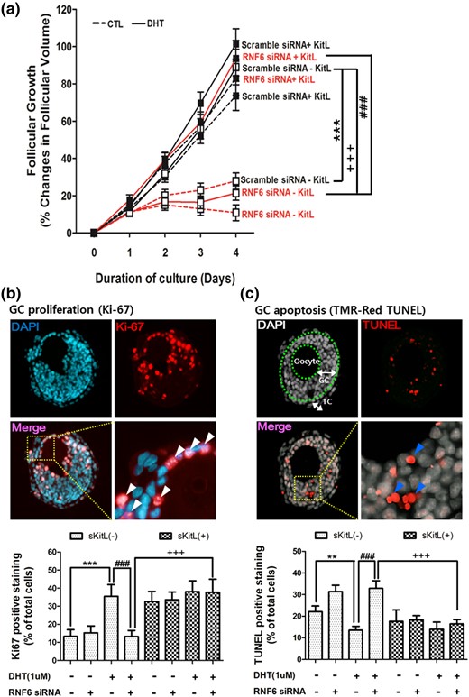 Exogenous sKit-L restores preantral follicular growth downregulated by RNF6 silencing in vitro. (a) RNF6 siRNA was microinjected into the GC layer of preantral follicle (110 to 150 μm) from 14-day-old rats and cultured for 4 days with DHT (0 and 1 µm) in the absence or presence of sKit-L (100 ng/mL). Changes in follicular volume (assessed daily) were expressed as means ± standard error of the mean (SEM) of 25 follicles (n = 3 replicates for each experiment with 10/10/5 follicles per group). ***P < 0.01 versus CTL; ###P < 0.001 versus DHT alone; +++P < 0.001 versus DHT and RNF6 siRNA. After the 4-day culture period, proliferating or apoptotic cells in the cultured follicles were analyzed by Ki67 (b) or TUNEL (c) and expressed as means ± SEM of 12 follicles (n = 3 replicates for each experiment with four follicles per group) and as a percentage of total cell number. (b) ***P < 0.01 versus CTL; ###P < 0.001 versus DHT alone; +++P < 0.001 versus DHT and RNF6 siRNA. (c **P < 0.01 versus CTL; ###P < 0.001 versus DHT alone; +++P < 0.001 versus DHT and RNF6 siRNA. TC, theca cell layer. White (Ki67) or blue (TUNEL) arrow heads indicate positive signal.