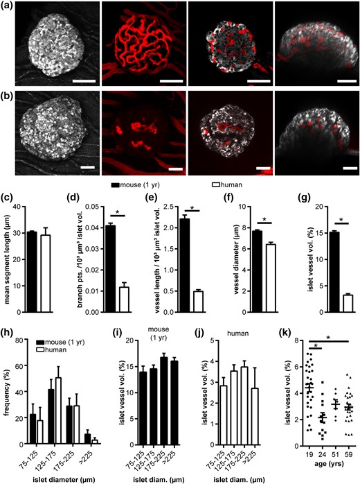 Vascular network of adult human and 1-year-old mouse islets after transplantation. (a) In vivo fluorescence images of a mouse and (b) human islet engrafted in the AC of a mouse. Images show MIPs of backscatter light (gray) and vessels (red), as well as selected XY and XZ image planes. (c–g) Vessel network analysis of transplanted mouse and human islets in vivo, showing (c) mean segment vessel length, (d) normalized number of branch points, (e) normalized vessel length, (f) vessel diameter, and (g) islet vessel volume fraction. (h) Distribution of transplanted mouse and human islet size. (i,j) Islet vessel volume fraction grouped by islet size for (i) mouse and (j) human islets. (k) Human islet vessel volume fraction grouped by donor age. Values are given as mean ± SEM for 6 mice (n = 44 mouse islets; 7.3 ± 0.4 islets per mouse) and 13 mice (n = 77 human islets; 5.9 ± 0.6 islets per mouse). *P < 0.05. Scale bars = 50 μm. diam, diameter.