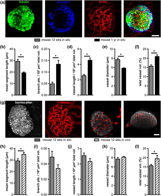 Effect of age on mouse islet vascularization in situ and in vivo. (a) Fluorescence images of a mouse islet within pancreas tissue slices from a 12-week-old mouse. Images show MIPs of staining for insulin (green), glucagon (blue), and blood vessels (red), as well as a merged MIP. (b–f) Comparison of vascular network parameters of islets from young (12 weeks) and aged (1 year) mice in situ: (b) mean vessel segment length, (c) normalized number of branch points, (d) normalized vessel length, (e) mean vessel diameter, and (f) mean islet vessel volume fraction. (g) In vivo fluorescence images of a mouse islet (12-week-old donor mouse) engrafted in the AC of a mouse. Images show MIPs of backscatter light (gray) and vessels (red), as well as selected XY and XZ image planes. (h–l) Comparison of vessel networks of young mouse islets in situ and after transplantation into the AC of mice in vivo, showing (h) mean segment vessel length, (i) normalized number of branch points, (j) normalized vessel length, (k) vessel diameter, and (l) islet vessel volume fraction. Values are given as mean ± SEM for (b–f) 9 mice (n = 74 islets; 8.2 ± 0.8 islets per mouse) at the age of 12 weeks and 10 mice (n = 97 islets; 9.7 ± 0.7 islets per mouse) at the age of 1 year in situ; (h–l) 6 mice (n = 35 islets; 5.8 ± 0.8 islets per mouse) for 12-week-old donors and 6 mice (n = 44 mouse islets; 7.3 ± 0.4 islets per mouse) for 1-year-old donors in vivo. *P < 0.05. Scale bars = 30 μm (a) and 50 µm (g).