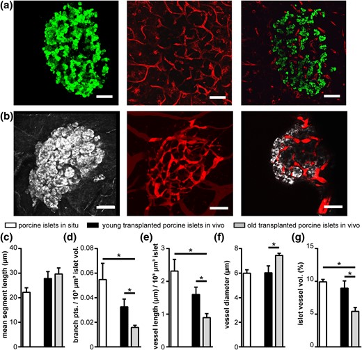 Vascularization of porcine islets in situ and after transplantation with different islet donor ages. (a,b) Images of (a) porcine islets in situ and (b) after transplantation to the AC of mice in vivo. Images show MIPs of insulin (green) or backscatter light (gray) and vessels (red), as well as a selected XY image plane. (c–g) Vessel network analysis of porcine islets in situ and after transplantation of young (6 to 18 months) and old (3 to 5 years) porcine donor islets to the AC of mice in vivo, showing (c) mean segment vessel length, (d) normalized number of branch points, (e) normalized vessel length, (f) vessel diameter, and (g) islet vessel volume fraction. Values are given as mean ± SEM for 3 pigs (n = 27 islets; 9.0 ± 0.6 islets per pig) in situ, 6 mice for young porcine islet donors (n = 24 transplanted islets; 4.0 ± 1.0 islets per mouse), and 8 mice for old porcine islet donors (n = 33 transplanted islets; 4.1 ± 0.6 islets per mouse). *P < 0.05. Scale bars = 50 μm.