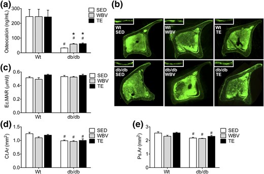 Exercise and WBV increase serum osteocalcin levels in db/db mice. (a) TE and WBV increase serum osteocalcin in db/db mice relative to SED db/db mice. (b) Micrographs show representative montages of tetracycline labeling in tibial cross-sections from the indicated groups. Scale bar = 200 µm. Insets show labeled surfaces visualized after two injections of tetracycline, with 10 days between injections. (c) Analysis of endocortical mineral apposition rates (Ec.MARs) in tibial cross-sections revealed no significant effect of genotype or intervention. (d) db/db mice exhibit reductions in cortical bone area (Ct.Ar) as determined by microCT analysis in the femur. (e) Leptin receptor deficiency reduces the periosteal area (Ps.Ar) in femur samples, as determined by microCT. For graphs, bars represent the average of (n = 6 to 8) mice in the indicated conditions, and hashtags denote the effect of genotype following 2 × 3 ANOVA with statistical significance at P < 0.05. Asterisks indicate significant differences relative to matched-genotype SED mice following one-way ANOVA with Bonferroni-corrected post hoc comparisons.