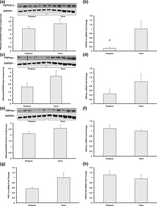 (a and b) Protein content and gene expression of PEPCK-C, (c and d) FBPase, and (e and f) and G6Pase and (g) gene expression of gluconeogenic coactivator PGC-1α and (h) gluconeogenic enzyme PEPCK-M were measured by Western blot and quantitative reverse transcription-PCR (n = 5 to 6 per group, *P < 0.05). Representative blots from each group are shown. All data shown as mean ± standard error of the mean.