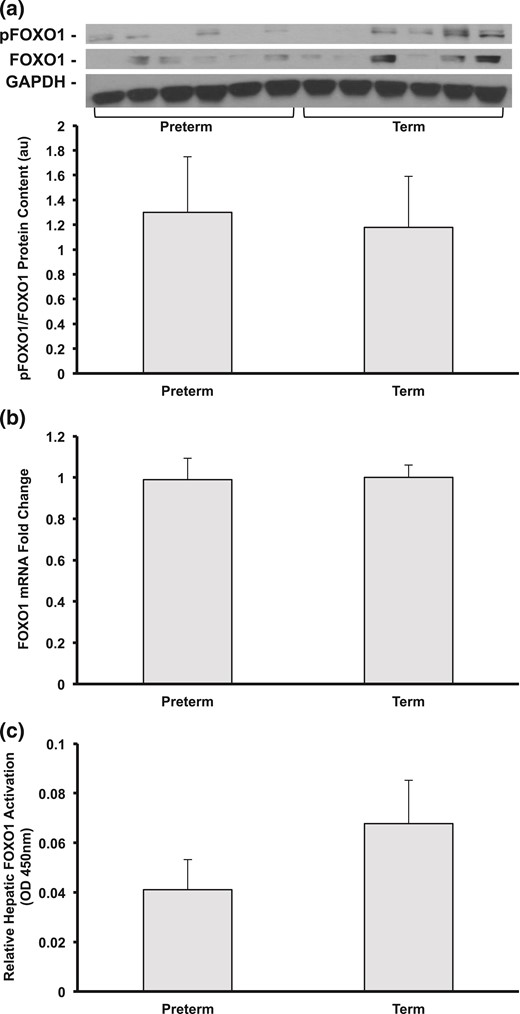 Representative blots from each group of phosphorylated FOXO1, normalized to (a) FOXO1, (b) gene expression of FOXO1, and (c) hepatic FOXO1 activity (n = 5 to 6 per group). All data shown as mean ± standard error of the mean. OD, optical density.