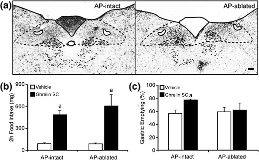 Ghrelin-induced gastric emptying is impaired in AP-ablated mice. (a) Representative images of thionin staining of the DVC of AP-intact and AP-ablated animals. Scale bars, 100 μm. (b and c) Bar graphs representing the 2-hour food intake and the percentage of gastric emptying, respectively, in AP-intact or AP-ablated mice treated with either vehicle or ghrelin. Data represent the mean ± SEM. aP < 0.05 vs vehicle groups.