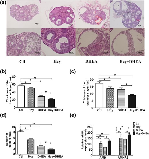 Hcy and DHEA affect the histomorphology of the mouse ovary. (a) The histological staining (hematoxylin and eosin staining) of representative ovaries on day 22 of treatment. Survey views show rat ovaries of control, Hcy, DHEA, Hcy + DHEA. Scale bar =100 μm. Comparison of the thickness of the (b) theca cell layer and (c) granulosa cell layer, as well as the (d) number of corpora lutea in the mouse ovaries of four groups. (e) Comparison of the expression levels of AMH and AMH receptor 2 (AMHR2) of the follicles in the mouse ovaries of four groups (n = 8). *P < 0.05, one-way analysis of variance, with Tukey’s post hoc test. Ctl, control.