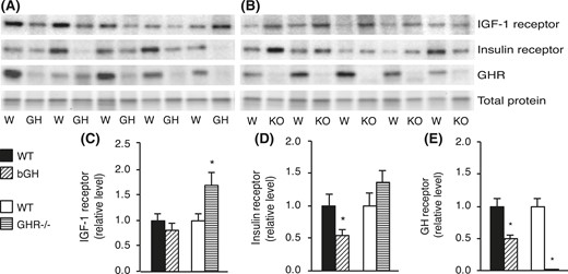 Protein levels in Sc adipose tissue from bGH and GHR−/− mice. Protein was isolated from Sc white adipose depots collected from bGH mice (diagonal-hatched bars) and WT control mice (black bars) (n = 10 per group) and from GHR−/− mice (horizontal-hatched bars) and WT control mice (white bars) (n = 8 per group). Representative Western blots of IGF-1R, IR, and GHR are shown for (A) bGH (GH) and WT (W) mice and for (B) GHR−/− (KO) and WT (W) mice. Protein levels of (C) IGF-1R, (D) IR, and (E) GHR were quantified and reported as mean ± standard error of the mean; *P < 0.05.