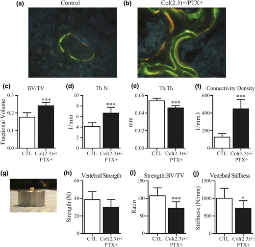 Dynamic labeling of cancellous bone at distal femur, and ex vivo assessment of L5 vertebral bodies from 12-month old female Col1(2.3)+/PTX+ and littermate control mice. Col1(2.3)+/PTX+ and Col1(2.3)+ littermate control mice were transferred from a doxycycline diet to a doxycycline-free diet at 8 weeks of age to induce PTX transgene expression in Col1(2.3)+/PTX+ mice and were aged to 12 months. (a, b) Representative images of dynamic histomorphometry of the distal femur in the female Col1(2.3)+/PTX+ and littermate control mice (green, calcein labeling given at −21 and −7 days; orange, demeclocycline labeling given at −2 days). (c–f) Ex vivo microCT assessment of the L5 vertebra. (g–j) Biomechanical properties of the L5 vertebral body assessed by compression testing. Before compression testing, the posterior elements and end plates of the vertebrae were removed to yield a vertebral body with plano-parallel ends, as imaged. All data are presented as mean ± standard deviation (n = 8 per group). *P < 0.05 vs control mice; ***P < 0.001 vs control mice.