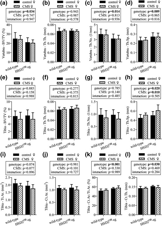 Skeletal phenotype in female mice. Micro-CT analysis is shown of vertebral (a) trabecular bone volume over total volume (BV/TV), (b) trabecular thickness (Tb.Th.), (c) trabecular number (Tb.No.), and (d) trabecular separation (Tb.Sp.) in WT and HSD2OB-tg females at endpoint, followed by tibial (e) trabecular bone volume (BV/TV), (f) trabecular thickness (Tb.Th.), (g) trabecular number (Tb.No.), and (h) trabecular separation (Tb.Sp.). Micro-CT analysis is shown of tibial (i) total periosteal envelope area (Tt.Ar.), (j) cortical area (Ct.Ar.), (k) cortical area fraction (Ct.Ar./Tt.Ar.), and (l) cortical thickness (Ct.Th.) (n = 8 per group). Data are presented as mean ± SD and were analyzed by two-way ANOVA followed by a Holm–Sidak post hoc test. *P < 0.05, **P < 0.01 vs genotype-matched control.