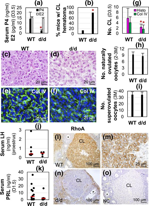 RhoAd/d (d/d) female infertility, hormonal profiles, and RhoA expression in CL. (a) Serum progesterone (P4, ng/mL) and estradiol (E2, pg/mL) levels in D3.5 female mice (n = 9 to 12). *P < 0.05. Error bar indicates standard deviation. (b) Percentage of mice with CL hematoma (n = 5 to 8). (c) WT D3.5 ovary histology. (d) D3.5 RhoAd/d (d/d) ovary histology. (e and f) Collagen IV immunofluorescence in (e) D3.5 WT and (f) RhoAd/d CL. (c–f) Images with lower magnifications are shown in Supplemental Fig. 2. (g) Average total number of CL per ovary in D3.5 ovaries by histology (Histo) and average number of CL per ovary from D3.5 ovary sections by collagen IV (Col IV) staining (n = 5 to 11). (h) Number of naturally ovulated oocytes per mouse from 2- to 3-month-old female mice detected on D0.5 (n = 5 to 9). (i) Number of superovulated oocytes per mouse from 3-month-old (3M) female mice (n = 4 or 5). In (a, g, h and i), *P < 0.05. Error bar indicates standard deviation. (j) Serum LH levels on proestrus stage (n = 4 to 7). (k) Serum prolactin (PRL) levels on D1.5 at 1800 hours (n = 6 to 14). (j and k) Each dot represents one individual mouse (2 to 3 months old); the red line indicates the median in each group. (l–o) RhoA immunohistochemistry. (l) RhoA expression in D3.5 WT ovary. (m) Enlarged from boxed area in (l) showing RhoA expression in luteal cells. (n) RhoA expression in D3.5 RhoAd/d ovary. (o) Negative control (NC) of a D3.5 WT ovarian section.