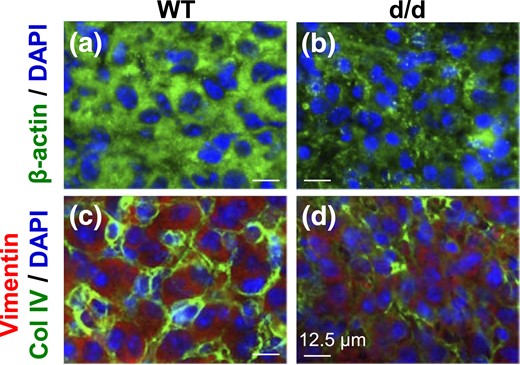Immunofluorescence detection of (a and b) β-actin and (c and d) vimentin in D3.5 (a and c) WT corpus luteum and (b and d) RhoAd/d corpus luteum. In (a and b), green indicates β-actin, and blue indicates DAPI staining nuclei. In (c and d), green indicates Col IV, red indicates vimentin, and blue indicates DAPI staining nuclei. Scale bar, 12.5 µm. (a–d) Images with lower magnifications are provided in Supplemental Fig. 5.