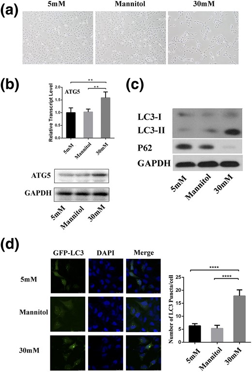 HG affects autophagy in HTR8/SVneo cells. (a) Micrograph of cells treated with mannitol and glucose for 24 hours (magnification ×100). (b) Relative expression of ATG5 measured using quantitative polymerase chain reaction and Western blotting in cells treated with HG. **P < 0.01. (c) Western blotting analysis demonstrated the expression of LC3 and p62 in cells treated with HG. (d) Representative images taken by confocal microscopy showed the fluorescent densities of LC3 in cells treated with glucose or mannitol in the presence of lysosomal protease inhibitors. Numbers of GFP-LC3 puncta per cell were counted. ****P < 0.0001. Scale bar = 20 μm. DAPI, 4′,6-diamidino-2-phenylindole; GAPDH, glyceraldehyde 3-phosphate dehydrogenase.
