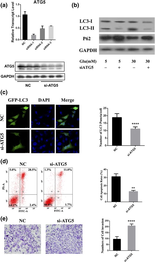 Silencing of ATG5 affects cellular behavior. (a) Relative expression of ATG5 in HTR8/SVneo cells transfected with siRNA. (b) HTR8/SVneo cells were treated with glucose for 24 hours, followed by siRNA transfection. LC3 and p62 levels were determined by Western blot. (c) Cells were cotransfected with GFP-LC3 and siRNA and then with HG for 24 hours, followed by pretreated lysosomal protease inhibitors. Cells were imaged under a confocal microscope. Scale bar = 20 μm. (d) Flow cytometry was used to measure cell apoptosis after transfected cells were incubated with HG for 24 hours. (e) Transwell slides of cells transfected with siRNA and then stimulated with glucose for 24 hours. Representative views show invaded cells stained as violet. Scale bar = 60 μm. DAPI, 4′,6-diamidino-2-phenylindole; FITC-A, fluorescein isothiocyanate assay; GAPDH, glyceraldehyde 3-phosphate dehydrogenase; Glu, glucose; NC, negative control; PI-A, propidium iodide assay; siATG5, short interfering ATG5. **P < 0.01; ****P < 0.0001.