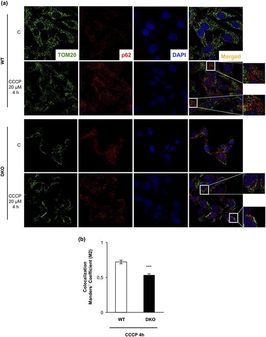 DKO brown preadipocytes showed an impaired p62-TOM20 colocalization upon 4 hour of CCCP treatment. (a) Representative immunofluorescence of TOM20, p62, and 4′,6-diamidino-2-phenylindole (DAPI) from brown preadipocytes obtained from WT or DKO mice under control conditions or CCCP treatment. In the CCCP treatment of both cell lines, two different regions are amplified in the insets. (b) After use of the Coloc2 plug-in (as explained in the Materials and Methods section), colocalization Manders coefficient after CCCP treatment is represented in the graph. Results are presented as mean ± standard error of the mean. Statistical significance was assessed by two-tailed Student t test; ***P < 0.001 between WT (n = 3) and DKO (n = 3) cells treated with CCCP for 4 hours.