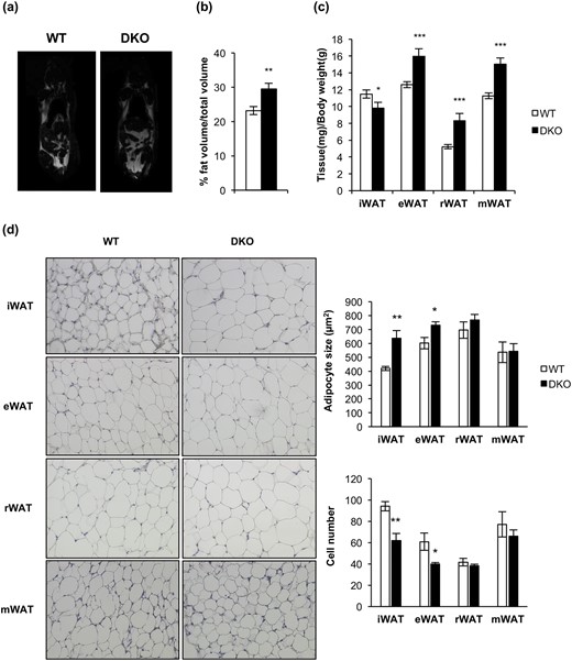 Loss of IGFIR/IR increased obesity susceptibility and induced a redistribution of the adipose organ. (a) Representative images from NMR comparing 3-month-old WT (n = 15) and DKO (n = 9) mice. (b) Quantification of NMR images. The results are presented as the percentage of fat volume per total volume. (c) Graph representing the epididymal WAT (eWAT), inguinal WAT (iWAT), retroperitoneal WAT (rWAT), and mesenteric WAT (mWAT) weights per total body weight comparing 3-month-old WT (n = 18) and DKO (n = 15) mice. (d) Hematoxylin and eosin–stained sections of different WAT depots from 3-month-old WT (n = 3) and DKO (n = 3) mice (magnification, ×20). White adipocyte size (square micrometers) from WAT depots is shown comparing 3-month-old WT (n = 3) and DKO (n = 3) mice (200 adipocytes per group) at magnification of ×20. Adipocyte number quantification from iBAT compartment comparing 3-month-old WT (n = 3) and DKO (n = 3) mice (six images per group). All results were presented as mean ± standard error of the mean. Statistical significance was assessed by two-tailed Student t test; *P < 0.05, **P < 0.01, and ***P < 0.001 between WT and DKO groups.