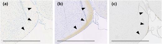 (a) and (b) High magnification images of adjacent sections of C57BL/6J mouse brain tissue focusing on the terminal field of accessory olfactory bulb projections. (a) mGLP-1R ISH showing lack of signal. (b) GLP-1R IHC with antibody MAb 7F38A2 showing positive staining. (c) GLP-1R IHC with antibody MAb 7F38A2 on a corresponding section from a Glp-1r−/− mouse brain showing negative staining. Original scale bars, 400 μm.