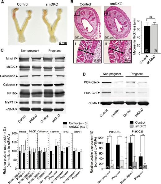 No abnormality in uterine morphology and smooth muscle–specific protein expression in control and C2α and C2β DKO mice. (A) Gross views of the uteri of control and smDKO nonpregnant mice. (B) Hematoxylin and eosin staining of uterine sections of control and smDKO nonpregnant mice and myometrial thickness of control and smDKO mice. The representative histological images (left) and quantified data (right) are shown. (C) Expression of various smooth muscle–specific proteins in the myometrial tissues of nonpregnant and pregnant (GD18.5) control and smDKO mice (top). The representative western blots (top) and quantified data (bottom) are shown. (D) Expression of C2α and C2β proteins in the myometrial tissues of nonpregnant and pregnant (GD18.5) control and smDKO mice (top). The representative western blots (top) and quantified data (bottom) are shown. In (B) and (D), the numbers in the columns denote the numbers of analyzed mice. The data in (B)–(D) are expressed as means ± SEM. *P < 0.05; **P < 0.01. ns, not significant.