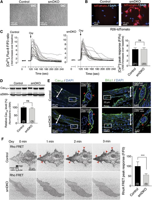 Diminished oxytocin-induced Rho activation, but not intracellular Ca2+ mobilization or Ca2+ channel protein expression, in myometrial smooth muscle cells from C2α and C2β DKO mice. Myometrial smooth muscle cells were isolated from control and DKO mice. (A) Phase-contrast images of myometrial smooth muscle cells. (B) Smooth muscle–specific expression of tdTomato fluorescent protein in mice that carries the R26-tdTomato reporter construct. Nuclei were stained with DAPI. (C) Oxytocin-induced increase in the [Ca2+]i in USM cells from control and smDKO mice. Cells were stimulated with 100 nM oxytocin. The quantified data show the [Ca2+]i peak response from 21 control and 20 smDKO cells. (D) Western blotting of L-type Ca2+ channel protein Cavα2 in USM cells from control and smDKO mice. (E) Immunofluorescent staining of the Ca2+ channel Cavα2 and the K+ channel BKα1 in the myometrium of control and smDKO mice. The boxed regions are shown as the magnified views obtained with SRRF microscopy. The red arrowheads denote Cavα2 protein of the L-type Ca2+ channel in the first SRRF view panel (left) and BKα1 protein of K+ channel of the last SRRF view panel (right). (F) FRET imaging of Rho activation in USM cells from control and smDKO mice. Left, representative images of Rho-FRET signals. Right, quantified data from nine control and nine smDKO cells. The peak/basal signal ratio in control cells was expressed as 100%. Red arrowhead denotes Rho activation signal. In (C), (D), and (F), the numbers in the columns denote the numbers of analyzed samples. The data in (C), (D), and (F) are expressed as means ± SEM. ***P < 0.001. M, myometrial layer of uterus; ns, not significant; Oxy, oxytocin.