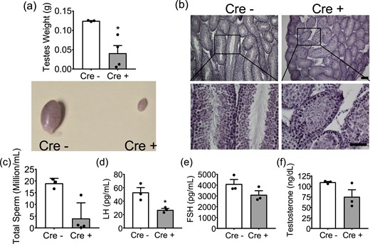 Six6flox/flox/LHRHcre male mice are hypogonadal and hypogonadotropic. (a) Testicular weight of Six6flox/flox (Cre−) and Six6flox/flox/LHRHcre (Cre+) mice (n = 3) with image of whole testes below. (b) Images of hematoxylin and eosin–stained Cre− and Cre+ testicles. Scale bar, 100 µm. (c) Sperm count in adult male mice (n = 3 or 4). Serum was collected from adult male mice and assayed for (d) LH (n = 5 or 6), (e) FSH (n = 5 or 6), and (f) testosterone (n = 4 to 7). Scale bar, 1 cm. All data were analyzed by Student t test as compared with control. *P < 0.05.