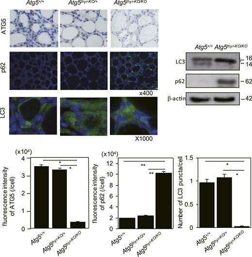 Immunohistochemical staining and western blot analysis of thyroid tissues from 4-month-old Atg5+/+, Atg5thyr-KO/+, and Atg5thyr-KO/KO male mice for ATG5, p62, and LC3. Mice (n = 3) were euthanized at 4 weeks of age. The thyroid glands were removed and subjected to immunohistochemical staining, western blotting, and quantification of expression levels as described in “Materials and Methods.” Note that quantification of ATG5 expression was performed using immunofluorescent staining of ATG5 (data not shown), although the pictures shown here are with HRP and 3, 3′-diaminobenzidine. Original magnifications: ×400 for ATG5 and p62; ×1000 for LC3. Data are means ± SE. *P < 0.05; **P < 0.01.